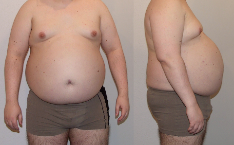 Mein Mastbauch